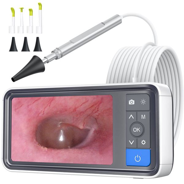 ScopeAround Otoscope Ear Camera with 4.5" IPS Screen, 1920x1080 FHD Smart Visual Ear Cleaner with Camera Tool Kit, Plug & Play at Home Ear Infection Detector Ear Wax Removal Camera with Light