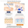 WELLDERMA NEEDLE 100 EXSOME MASK 5ea