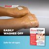 BloodSTOP-Hemo