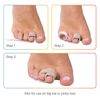 ZenToes Hammer Toe Corrector for Women & Men - Reusable Fabric Buddy Wraps for Broken Toes - Cushioned Toe Splint for Protection & Recovery & Hammertoe Straightener - 4 Count (OSFM, Beige)