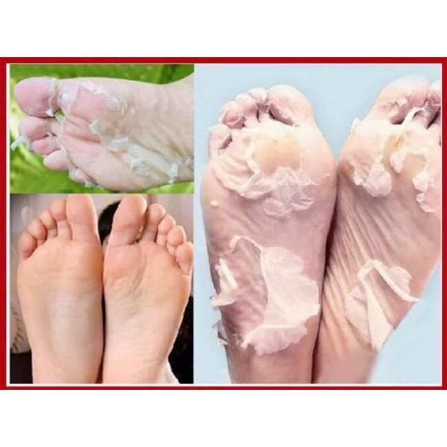 Purederm  Exfoliating Foot Mask Soft Feet Remove Scrub Callus Hard Dead Skin