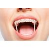 500 Pcs Orthodontic Elastic Rubber Bands, 3.5 Ounces Heavy Dental Rubber Traction Bands, Free Elastic Placer for Braces (1/4",Fox)