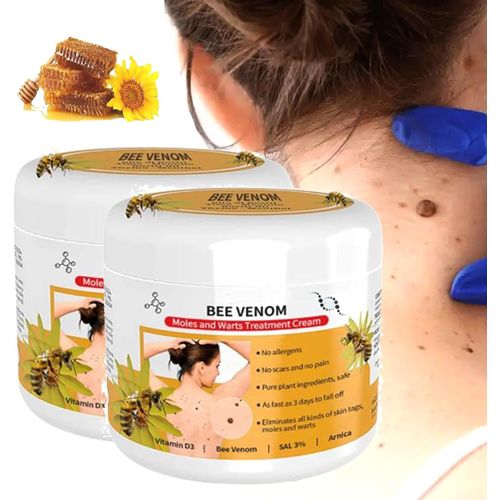 2pcs Bee Venom Moles and Warts Treatment Cream, Bee Venom Wart and Tag Remover, Bee Venom Cream for All Skin Types (30g)