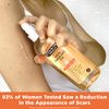 Palmer's Cocoa Butter Formula Skin Therapy Moisturizing Body Oil with Vitamin E, Rosehip Fragrance, 2 Ounces