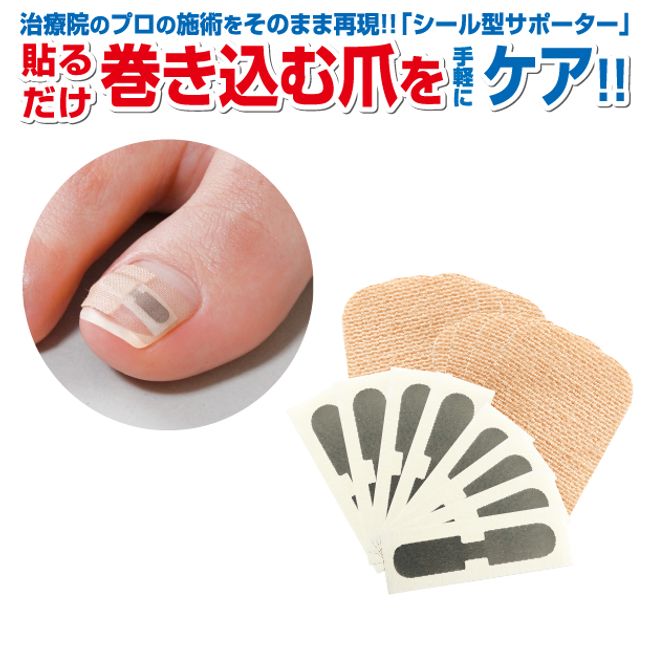 Ingrown toenail correction sticker Ingrown toenail tape Wire Ingrown toenail pain prevention Hard Ingrown toenail clip Ingrown toenail clip Block Tape Ingrown toenail wire guard