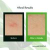 molvany Arti-cica Refresh Calming Serum