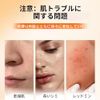 Vitamin C Whitening Whitening Cream
