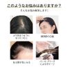 HIYE 部分ウィッグ 人毛100％ リアル 人工皮膚 自然 軽量 増毛 ウィッグ つむじ付き トップカバー 白髪 薄毛隠し 女性 ヘアピース 円形脱毛 ハゲ隠し 医療用ウィッグ 黒髪 横7cm縦10cm パッツンバング (30CM, 栗色)