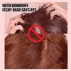 Sulfur Medicated Anti-Dandruff Conditioner for Braids, 356 ml