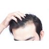 immune support herbs - DHT BLOCKER HAIR - selenium organic supplements 2B