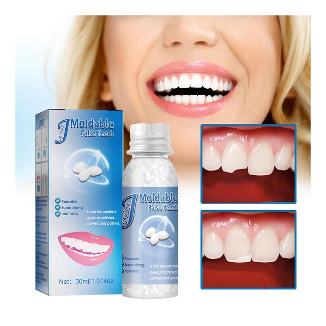 Temporary Tooth Repair Kit For Filling The Missing Broken Tooth And  Gaps-moldable Fake Teeth And Thermal Beads Replacement Kit