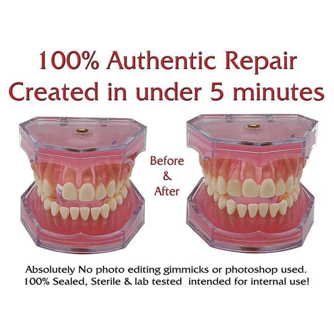 Temporary Tooth Repair Kit For Filling The Missing Broken Tooth And Gaps