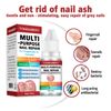 Fungal Nail Treatment for Toenails Extra Strong,Nail Fungus Treatment for Toenail,Toenail Fungus Treatment,Nail Repair for Fingernails Toenails,Strengthen Renew Damaged, Broken Nails