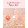 Glam Up Cosmetics Cover Patch Spot Patch Acne (1 Piece (36 Pieces)