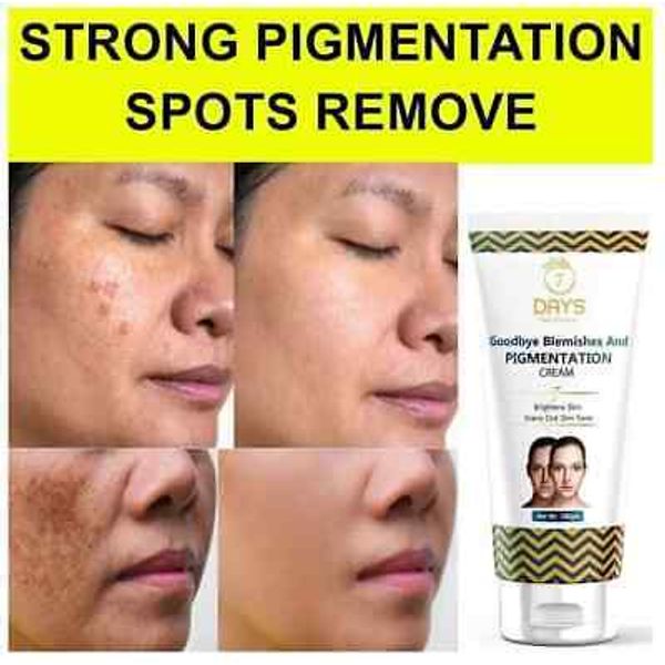 7 DAYS Anti Pigmentation Blemishes Spots Removal Face Cream 100g For Women & Men