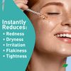 PROcure Rosacare Face Serum, Ultra-Hydrating Rosacea Treatment with Hyaluronic Acid & Niacinamide, Moisturizing, Instant Redness Relief to Reduce Skin Dryness, 1.08 Fl Oz (32mL)