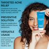 Vanibiss Butt & Thighs Acne Treatment Cream - Reduce Bum Acne, Pimples & Zits - Clearing Acne Lotion for Buttocks - 2% Salicylic Acid for Acne Prone Skin (4oz)