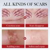 Scar Repair Serum