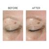 Avon Anew Lifting Dual Eye System with Protinol 20 ml / 0.66 fl oz
