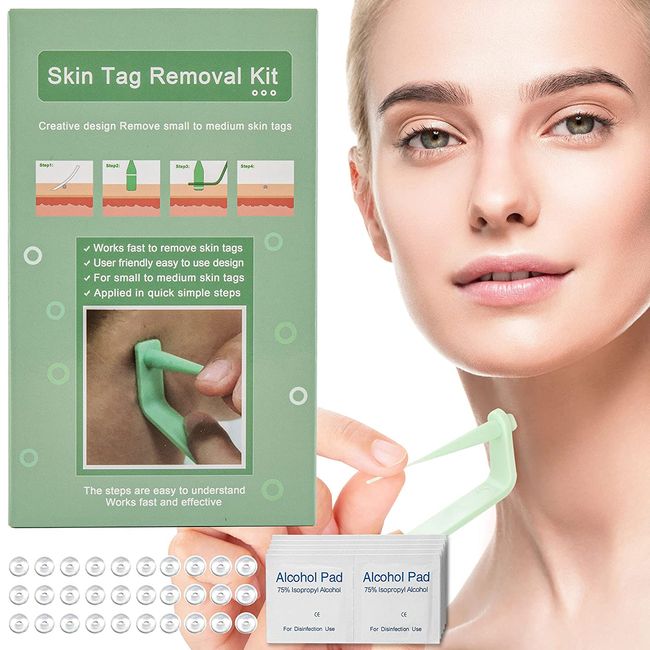 Skin Tag Remover, Skin Tag Remover Device with 20 Pcs Micro Bands for small to Medium (2mm to 4mm) Sized Skin Tags, Easy and Effective