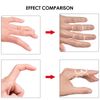 FunnAura 12PCS Finger Splints for Arthritis Kit, Trigger Thumb Splint Brace