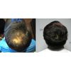 DAMO hair loss control scalp Tonic