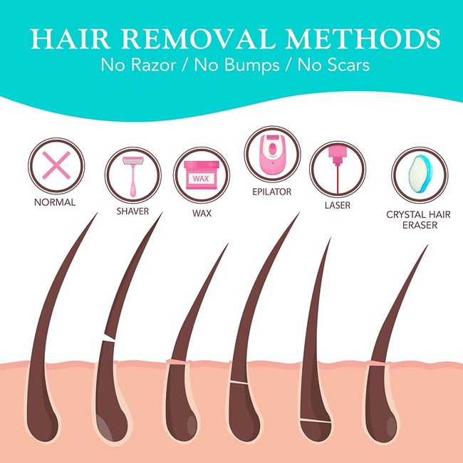 How Does Magic Crystal Hair Removal Work informacionpublica.svet.gob.gt