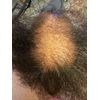 Hair  Miracle Growth oil