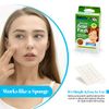 Acne Care Pimple Patch Absorbing Cover - Hydrocolloid Bandages (108 Count) Two Universal Sizes, Acne Spot Treatment for Face & Skin Spot Patch That Conceals Acne, Reduces Pimples and Blackheads