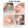 Acne Patch Pimple Patch, 4 Sizes 140 Patches Acne Absorbing Cover Patch, Hydrocolloid Invisible Acne Patches For Face Zit Patch Acne Dots Tea Tree, Calendula Oil - 1 Pack