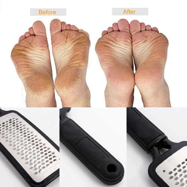 Stainless Steel Foot File, Professional Pedicure Metal Tool Heel Foot Scraper for Dead Skin, Callus, Cracked Heels, Hard Skin Remover (Black), Size