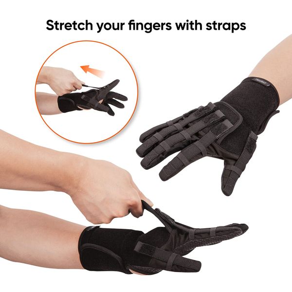 NEOFECT Extender Plus Medium Right, Hand Brace for Stroke Patients, Stroke hand therapy Equipment, Stroke Recovery Equipment, Finger rehabilitation glove