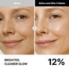 THOME G-Peel Program 4 Week Kit – Hydrating & Firming Korean Facial