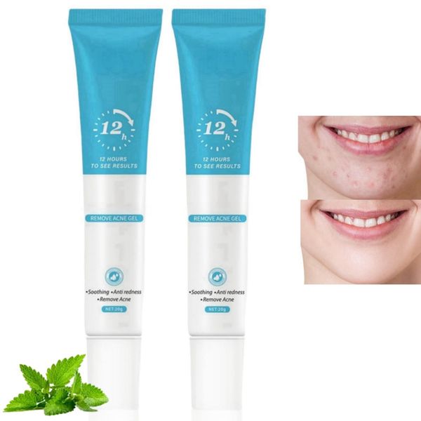 2PCS Acne Treatment Gel,Acne Scar Treatment for Women,Anti-Acne Cream,Dark Spot Remover for Face,Repair Shrink Pores,Face Spot Treatment,Moisturizing Gel for Acne Treatment and Spot Treatment