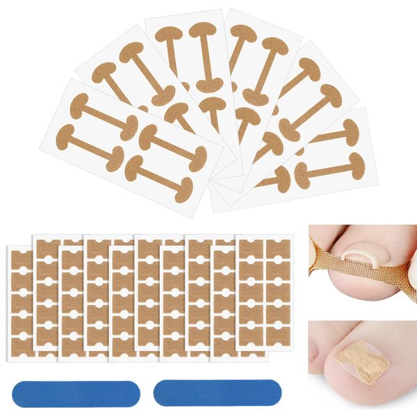 Ingrown Toenails Tool Set 126 Pieces Toenails Correction Patch, Toenail Elastic Patch Correction Plaster with Nail File, Pedicure Toenails Sticker Correction Plaster