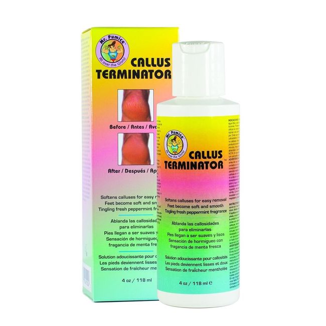 Callus Remover Gel Callus Eliminator Liquid Gel For Corn Feet Heel  Treatment New