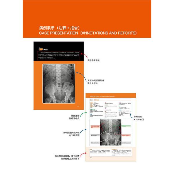 放射学非官方指南：100例腹部X线片实践（全彩注释 完整报告）