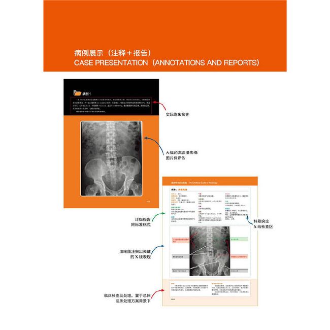 放射学非官方指南：100例腹部X线片实践（全彩注释 完整报告）