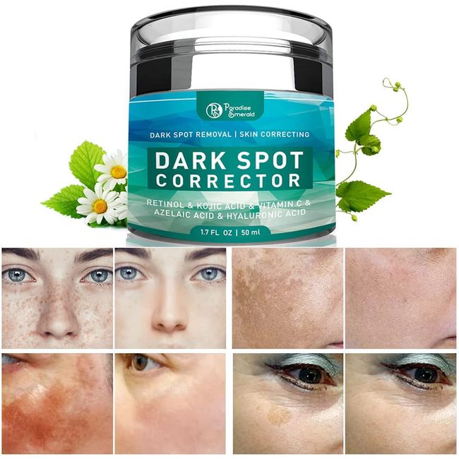 Emerald Dark Spot Remover: Skin Hyperpigmentation Treatment