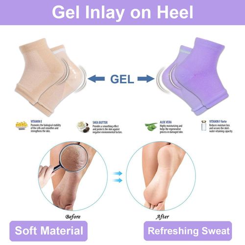 2 Pairs Moisturizing Socks, Gel Heel Socks, Toe Open Socks, Relieve Heel Pain Comfortable Soft Vented Moisturizing Socks Suitable for Male and Female Day Night Care Skin Dry Cracked High Heel