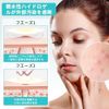     360  14mm 12mm 10mm 8mm          