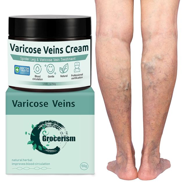 Crema Para Las Varices Elimina Verrugas ys Arañitas Venas Borra Las Varicosas