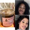 Whitening Herbal Exfoliating Soap (350g)
