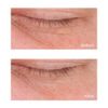 Perricone MD Cold Plasma Plus+ Eye Advanced Eye Cream, 15ml