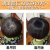 Luce brillare Wig, Men's, Women's, Wig, Partial Wig, Men's, Women's, Whorl, Top of Head, Human Hair, Short, Domestic Manufacturer, Hair Plus + (Natural Black)