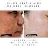 Black Soap for Rashes: Soothe Irritated Skin