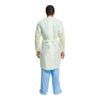 Halyard Basics Disposable SMS Protective Procedure Gown X-Large 10 per Bag