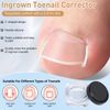 Ingrown Toenail Corrector Set,Toenail Correction Strips,Professional Ingrown Corrector Patch,with File and Lifter Pedicure Tools
