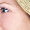 Stem Cell Therapy Cream