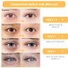 BREYLEE Vitamin C Serum for Face & Eye (1.4 oz) for Brightening Skin,Dark Spot Remover,Reduce Wrinkle,Anti Aging ,Moisturizer with Hyaluronic Acid,Vitamin E,Retinol,Nicotinamide